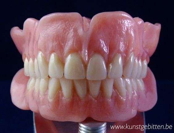 Prótesis dental