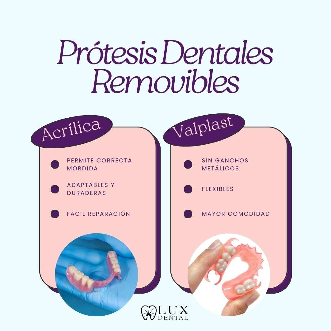 Diferencia entre prótesis dental acrílica tradicional y prótesis Valplast flexible