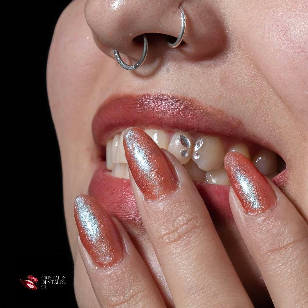 Joyería dental con cristales