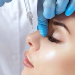 Rinomodelacion-Tratamiento-Facial