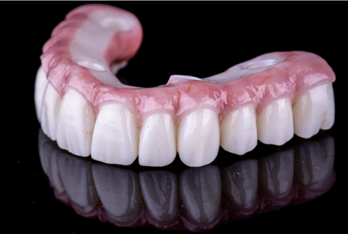 Prótesis Zirconia Hibrida Monolítica